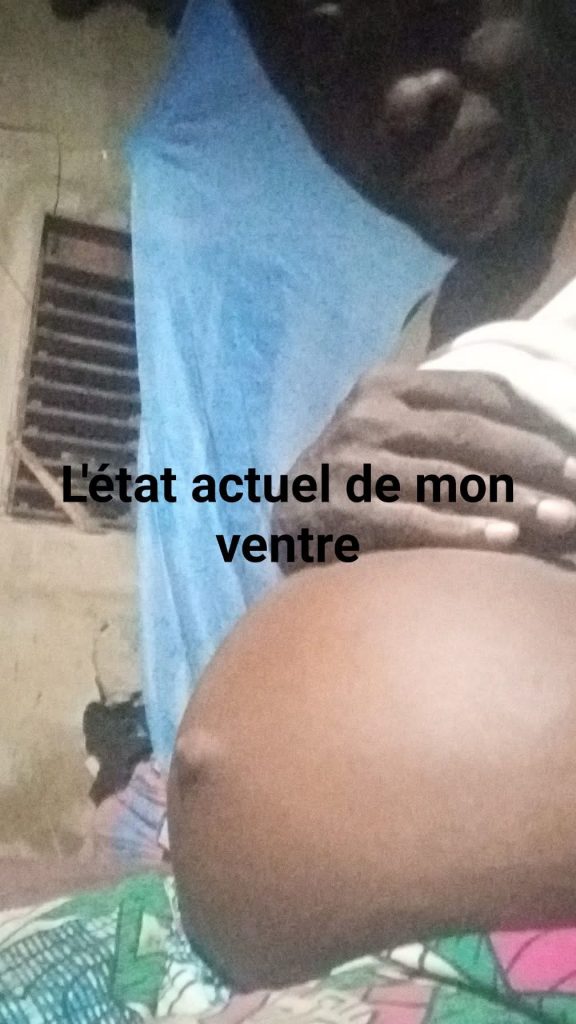 Situation critique des dialysés au Bénin : Judicaël Gbaguidi, un cri de détresse qui interpelle la responsabilité sociale du gouvernement